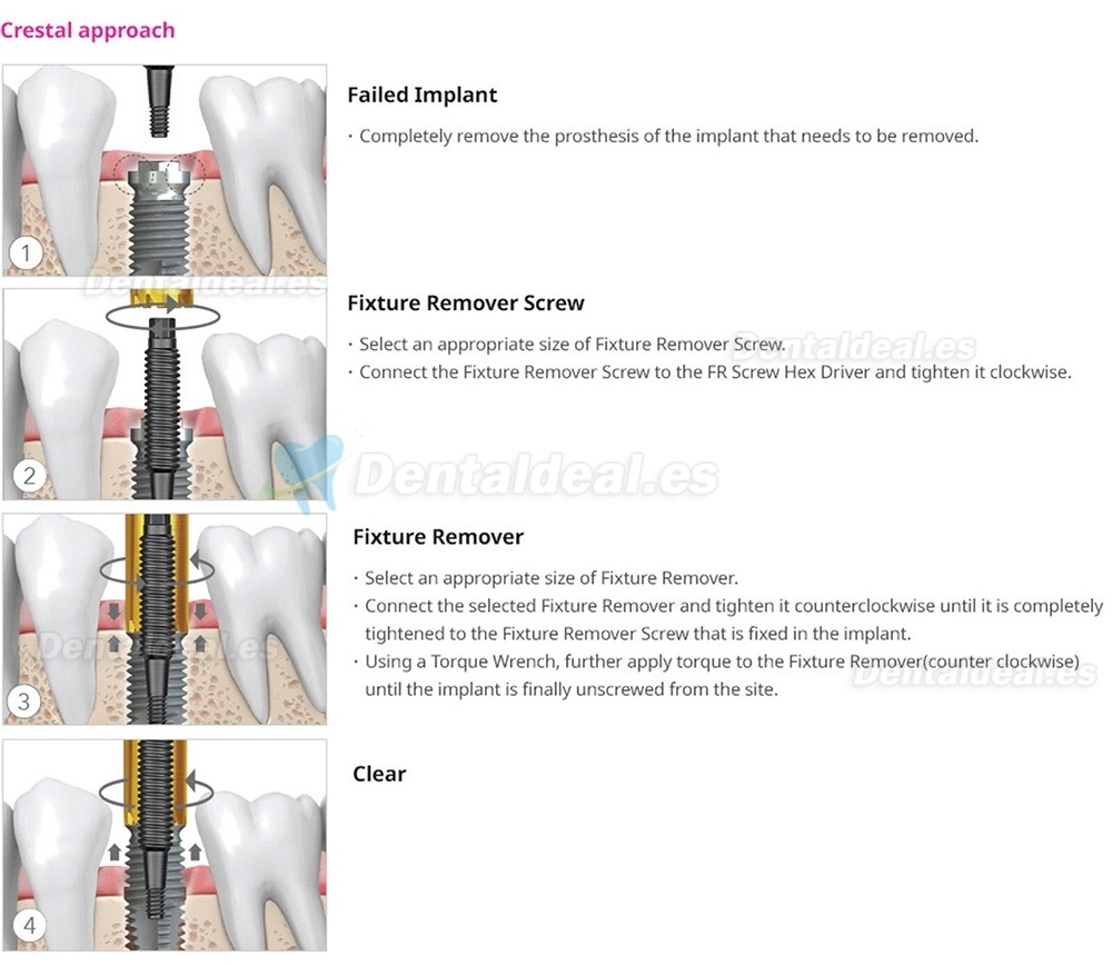Kit de Extracci&oacute;n de Implantes Dentales con Llave de Torque y Carraca